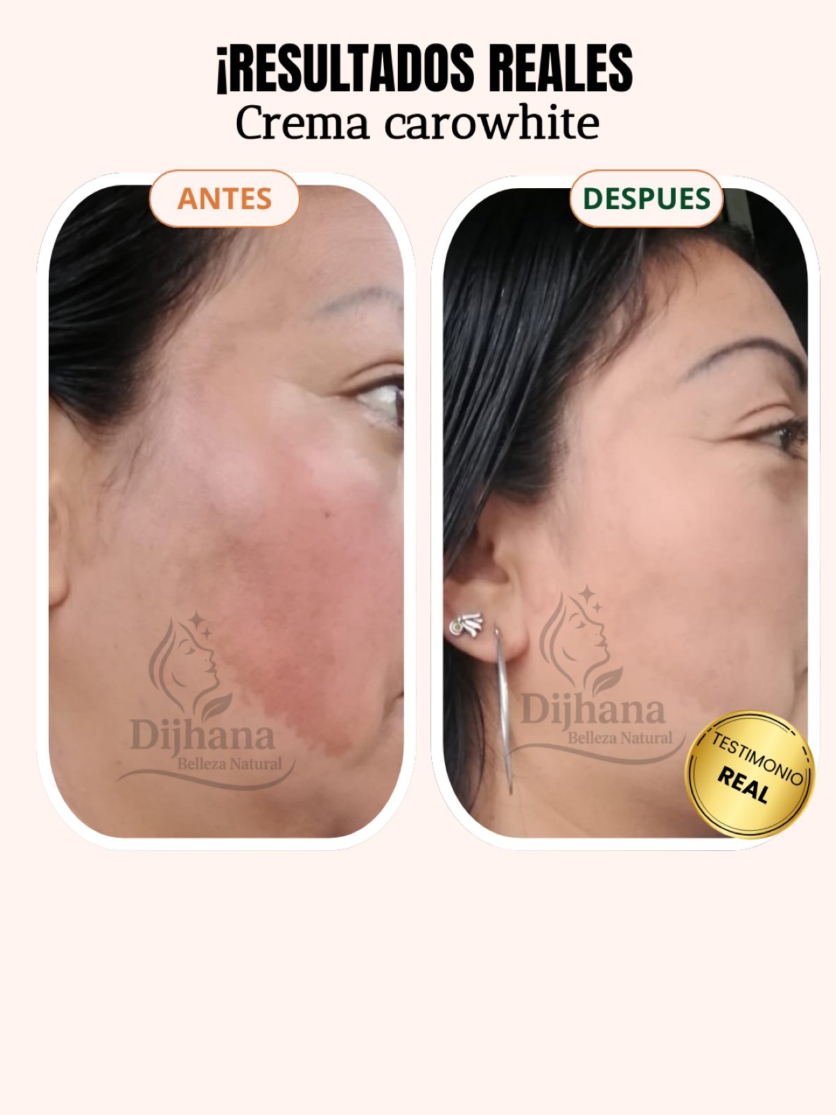 Post testimonio DIJHANA - 1