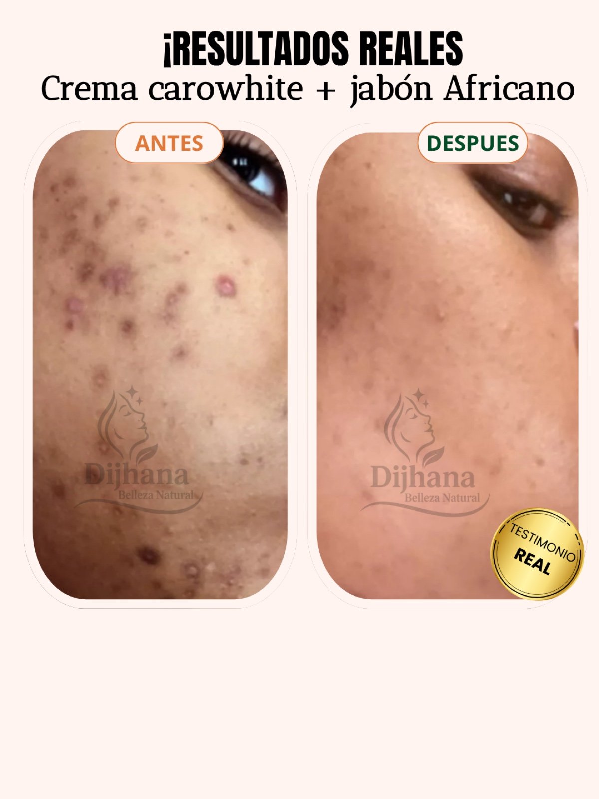 Post testimonio DIJHANA - 2