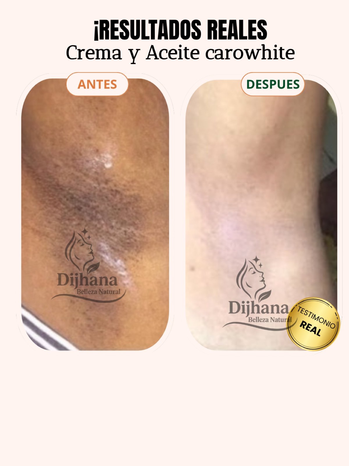 Post testimonio DIJHANA - 5