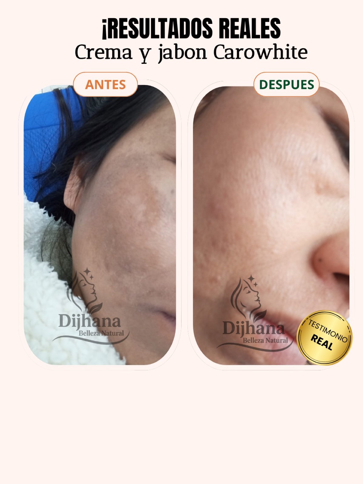 Post testimonio DIJHANA - 7
