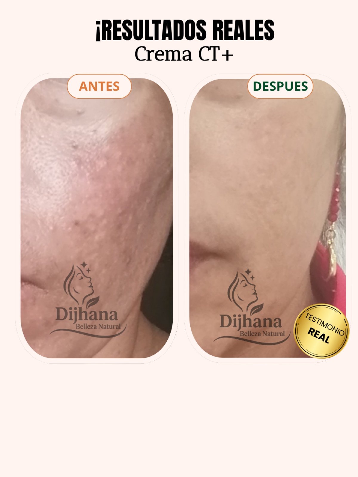 Post testimonio DIJHANA - 9